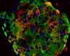Ученые нашли в поджелудочной железе стволовые клетки