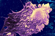 Иммунным клеткам вернут способность атаковать опухоли
