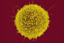 Американцы вылечили неоперабельный рак собственными иммунными клетками пациента