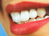 Защитим зубы от кариеса
