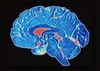 Найдены два гена, ответственные за возникновение рака головного мозга