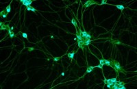 Ученые нашли новый вид стволовых клеток 