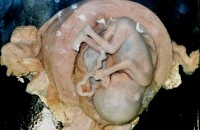 Эмбрион человека не чувствует боль, - ученые 