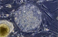 Ученые нашли стволовые клетки в женских яичниках